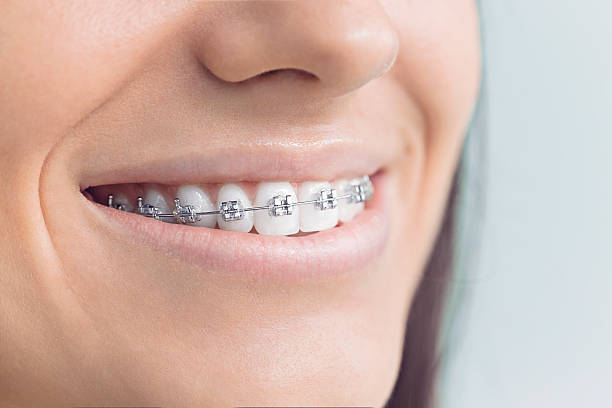 Best Invisalign and Clear Aligners  in Bourg, LA